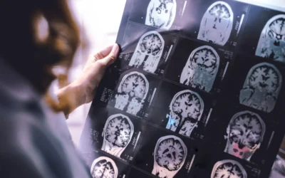 What May Prompt a Brain Stem Injury?